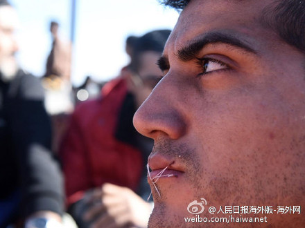 希腊边境难民缝嘴绝食抗议