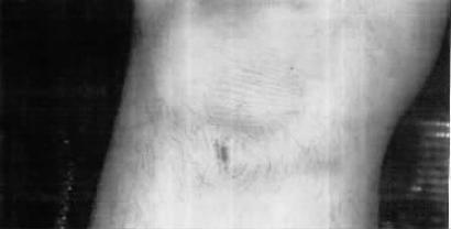 美国十几年后公开虐囚照片 多是皮外伤特写 